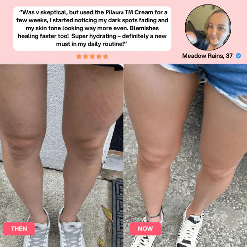 Pilaura™ Cellulite Relief Kit 2