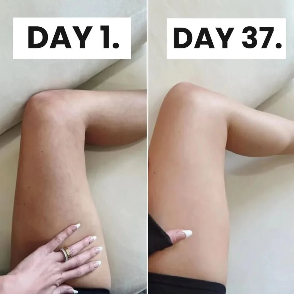 Pilaura™ Cellulite Relief Kit 2