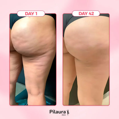 Pilaura™ Cellulite Relief Kit 2